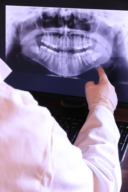 Best Emergency Dental Care for Sports Injuries in Locust Valley, NY